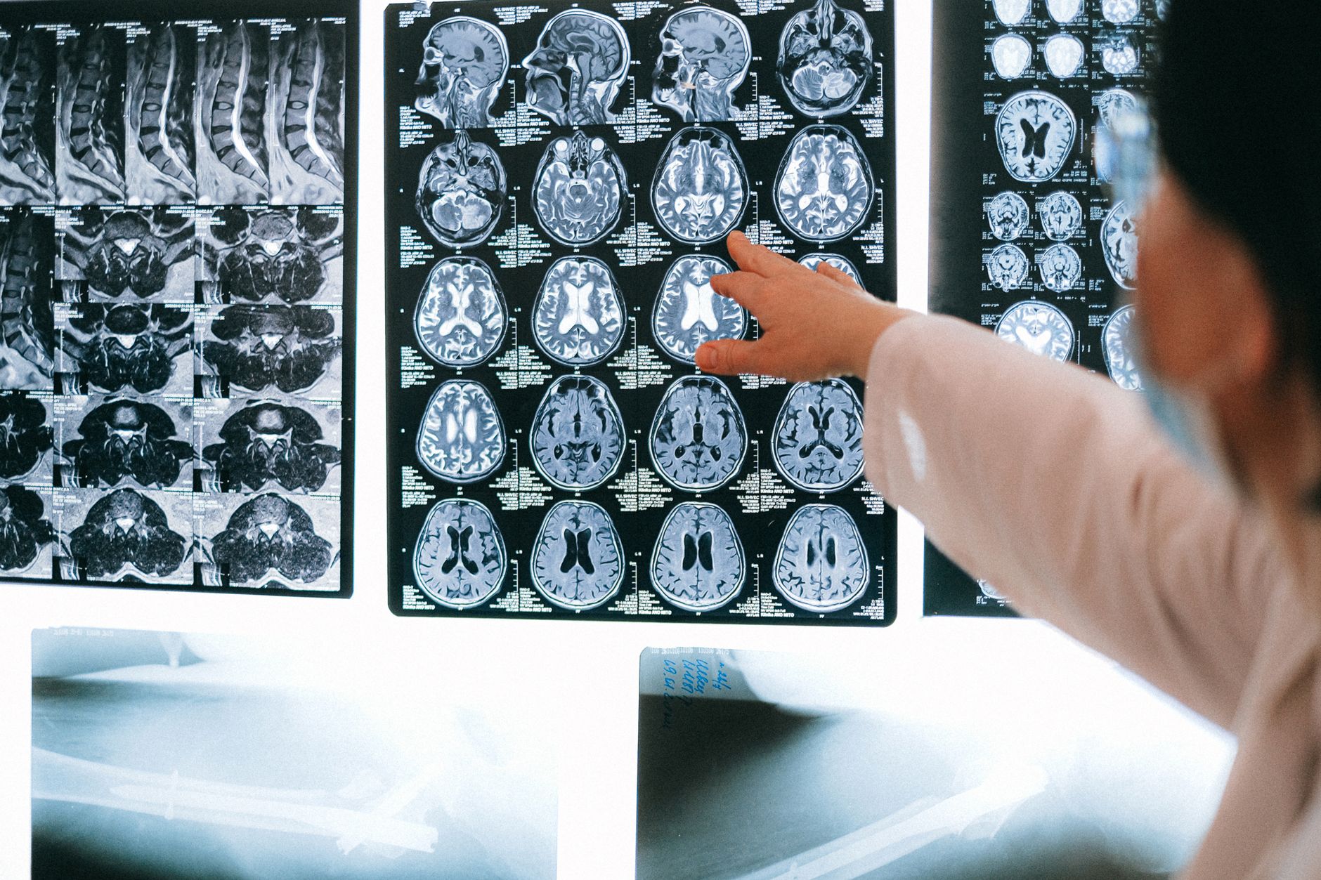 Close-up of a colorful brain scan on a medical monitor